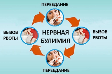 Лечение булимии в Людиново